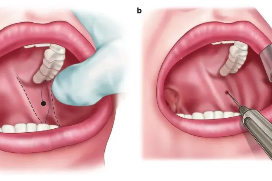 نحوه صحیح اجرای آن و جلوگیری از خطاهای رایج